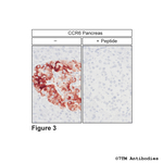 CCR6 Chemokine Receptor 6 Polyclonal Antibody