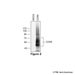 CCR6 Chemokine Receptor 6 Antibody in Western Blot (WB)