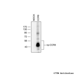 CCR8, CCR8 Chemokine Receptor Polyclonal Antibody