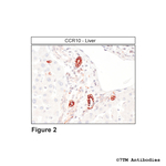 CCR10, Chemokine Receptor 10 Antibody in Immunohistochemistry (Paraffin) (IHC (P))