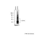 CCR10, Chemokine Receptor 10 Antibody in Western Blot (WB)