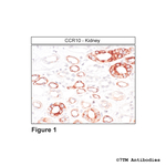 CCR10 Chemokine Receptor 10 Antibody in Immunohistochemistry (Paraffin) (IHC (P))