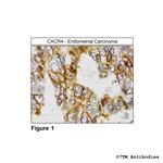 CXCR4, CXC Chemokine Receptor 4 Polyclonal Antibody
