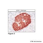 XCR1, XCR Chemokine Receptor 1 Antibody in Immunohistochemistry (Paraffin) (IHC (P))