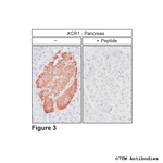 XCR1, XCR Chemokine Receptor 1 Polyclonal Antibody