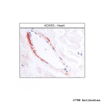 ACKR3, Atypical Chemokine Receptor 3 Antibody in Immunohistochemistry (Paraffin) (IHC (P))