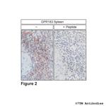 GPR183, Oxysterol Receptor Antibody in Immunohistochemistry (Paraffin) (IHC (P))