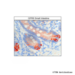 GPR6, G protein-coupled Receptor 6 Antibody in Immunohistochemistry (Paraffin) (IHC (P))
