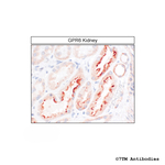GPR6, G protein-coupled Receptor 6 Antibody in Immunohistochemistry (Paraffin) (IHC (P))
