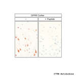 GPR6, G protein-coupled Receptor 6 Antibody in Immunohistochemistry (Paraffin) (IHC (P))