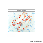 GPR12, G Protein-Coupled Receptor 12 Antibody in Immunohistochemistry (Paraffin) (IHC (P))