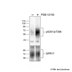 Phospho-GPR17 (Ser351, Thr356) Antibody in Western Blot (WB)