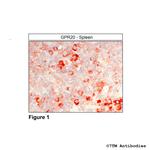 GPR20, G Protein-Coupled Receptor 20 Polyclonal Antibody