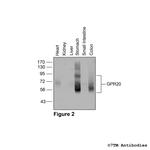 GPR20, G Protein-Coupled Receptor 20 Antibody in Western Blot (WB)