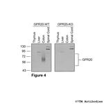 GPR20, G Protein-Coupled Receptor 20 Antibody in Western Blot (WB)
