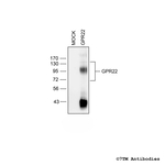 GPR22, G protein-coupled Receptor 22 Antibody in Western Blot (WB)
