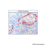 GPR22, G Protein-Coupled Receptor 22 Antibody in Immunohistochemistry (Paraffin) (IHC (P))