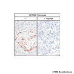 GPR22, G Protein-Coupled Receptor 22 Polyclonal Antibody