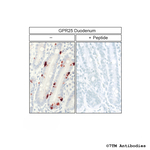 GPR25, G Protein-Coupled Receptor 25 Antibody in Immunohistochemistry (Paraffin) (IHC (P))
