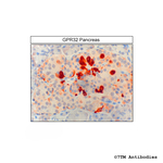 GPR32, G Protein-Coupled Receptor 32 Antibody in Immunohistochemistry (Paraffin) (IHC (P))