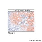 GPR35, G Protein-coupled Receptor 35 Antibody in Immunohistochemistry (Paraffin) (IHC (P))