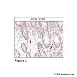 GPR35, G Protein-coupled Receptor 35 Antibody in Immunohistochemistry (Paraffin) (IHC (P))