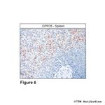GPR35, G Protein-coupled Receptor 35 Antibody in Immunohistochemistry (Paraffin) (IHC (P))