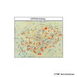 GPR39, G protein-coupled Receptor 39 Antibody in Immunohistochemistry (Paraffin) (IHC (P))