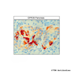 GPR39, G Protein-Coupled Receptor 39 Antibody in Immunohistochemistry (Paraffin) (IHC (P))