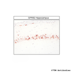 GPR82, G protein-coupled Receptor 82 Antibody in Immunohistochemistry (Paraffin) (IHC (P))