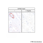 GPR82, G protein-coupled Receptor 82 Antibody in Immunohistochemistry (Paraffin) (IHC (P))