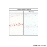 GPR82, G Protein-Coupled Receptor 82 Polyclonal Antibody