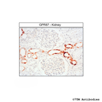 GPR87 (G Protein-Coupled Receptor 87) Antibody in Immunohistochemistry (Paraffin) (IHC (P))