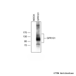 GPR101, G protein-coupled Receptor 101 Polyclonal Antibody