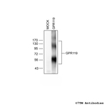 GPR119, G protein-coupled Receptor 119 Antibody in Western Blot (WB)