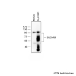 SUCNR1/GPR91, Succinate Receptor Antibody in Western Blot (WB)