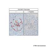 SUCNR1/GPR91, Succinate Receptor Polyclonal Antibody