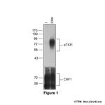 Phospho-Corticotropin-Releasing Factor Receptor 1 (Thr431) Polyclonal Antibody