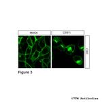 CRF1, Corticotropin-Releasing Factor Receptor 1 Antibody in Immunocytochemistry (ICC/IF)