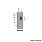D1, Dopamine Receptor 1 Antibody in Western Blot (WB)