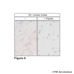 D5, Dopamine Receptor 5 Polyclonal Antibody