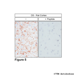 D5, Dopamine Receptor 5 Antibody in Immunohistochemistry (Paraffin) (IHC (P))