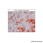 ETA (Endothelin Receptor A) Antibody in Immunohistochemistry (Paraffin) (IHC (P))