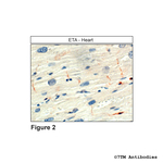 ETA (Endothelin Receptor A) Polyclonal Antibody