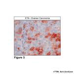 ETA, Endothelin Receptor A Antibody in Immunohistochemistry (Paraffin) (IHC (P))