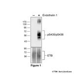 Phospho-Endothelin Receptor B (Ser435, Ser436) Polyclonal Antibody