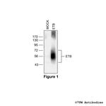ETB (Endothelin Receptor B) Polyclonal Antibody