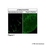 Phospho-FFA2 (Thr306, Thr310) Polyclonal Antibody