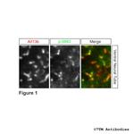 Phospho-SMO Receptor (Ser594, Thr597, Ser599) Polyclonal Antibody