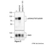Phospho-SMO Receptor (Ser594, Thr597, Ser599) Antibody in Western Blot (WB)